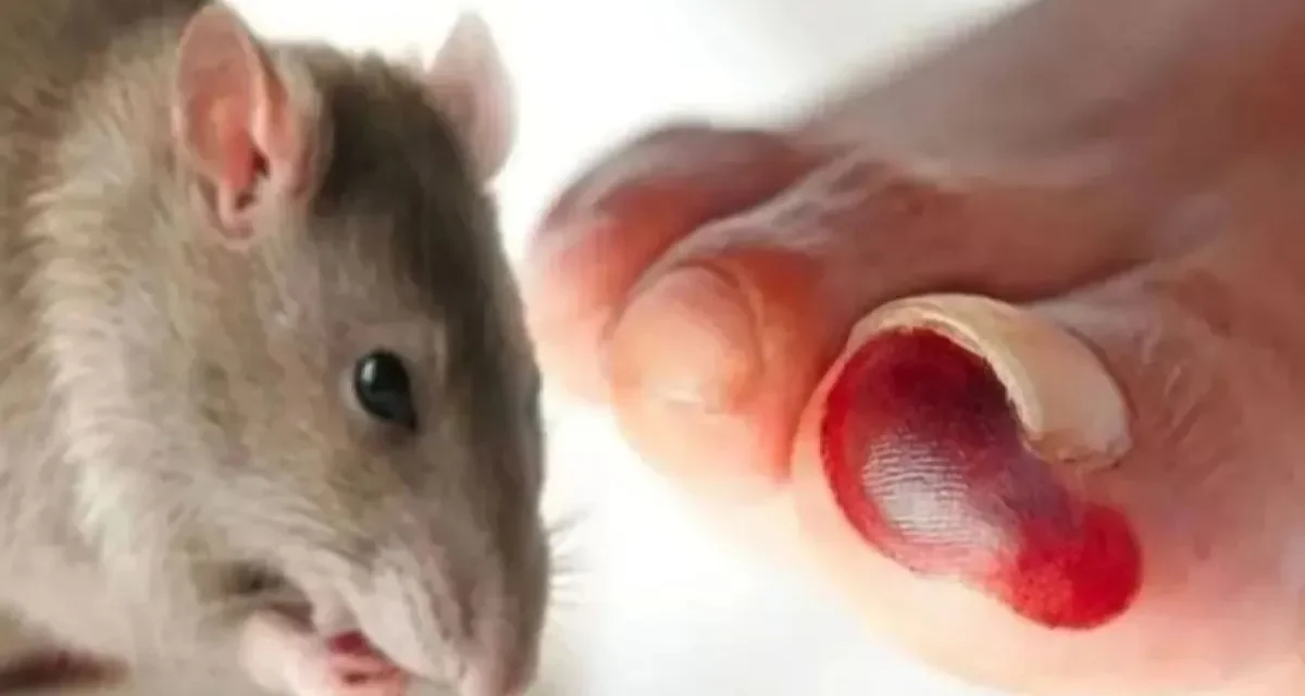 Waspada Hantavirus: Penularan, Gejala Awal, Risiko Kesehatan