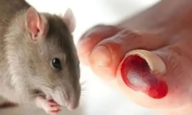 Waspada Hantavirus: Penularan, Gejala Awal, Risiko Kesehatan