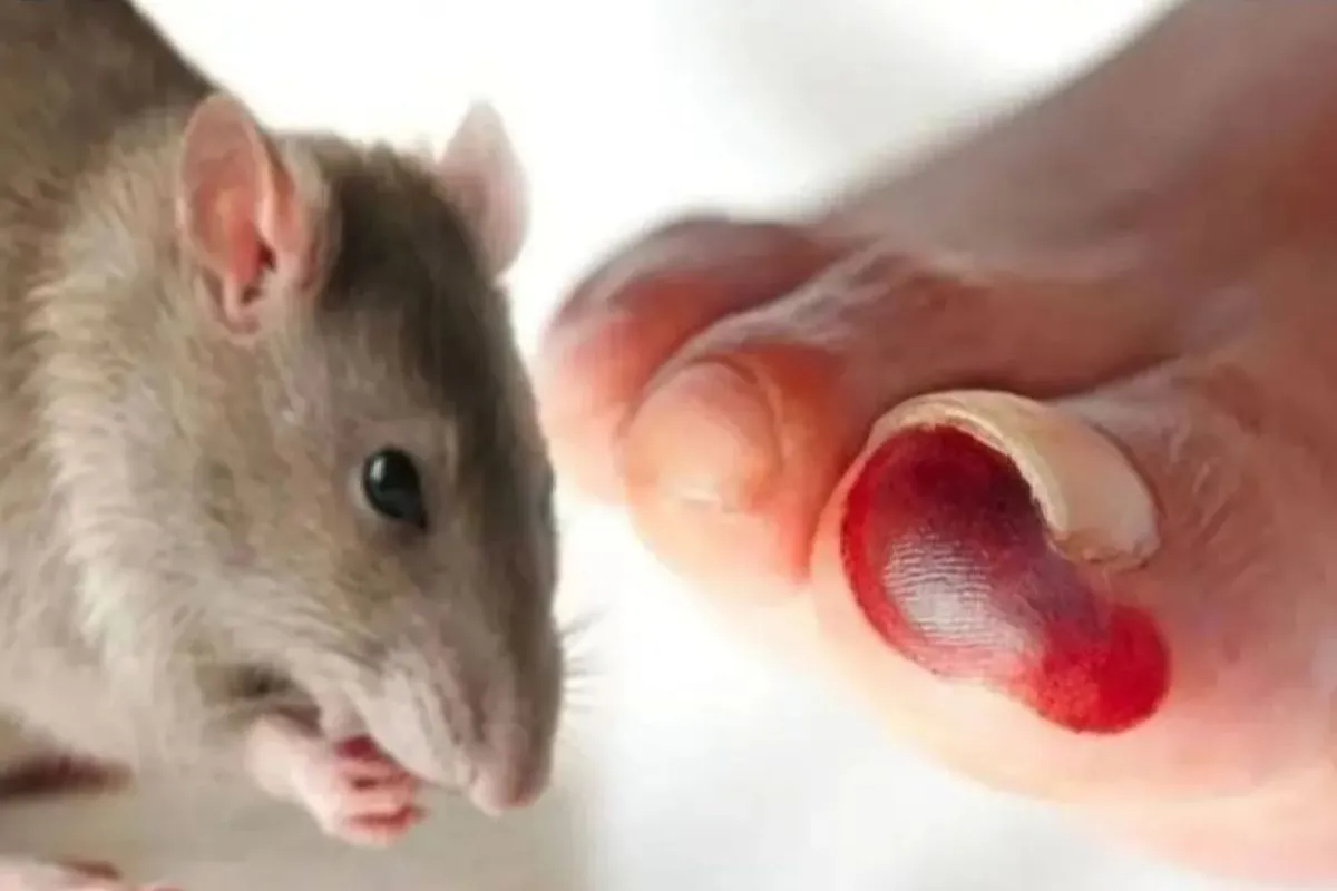 Hantavirus